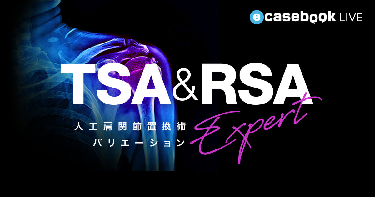 TSA & RSA Expert | e-casebook