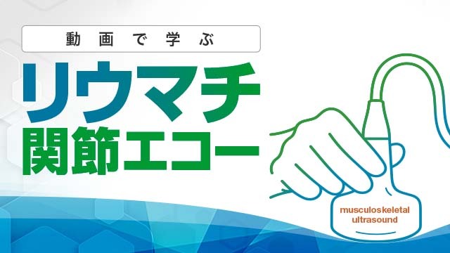 動画で学ぶリウマチ関節エコー | e-casebook