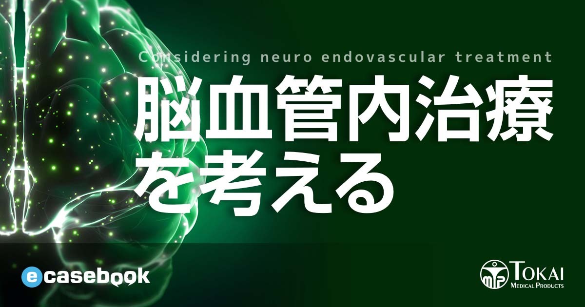 脳血管内治療を考える | e-casebook